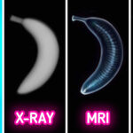 xray