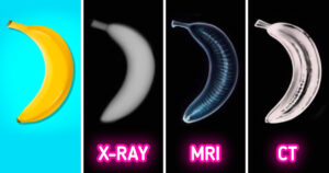 xray
